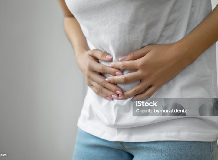 PCOS symptoms
